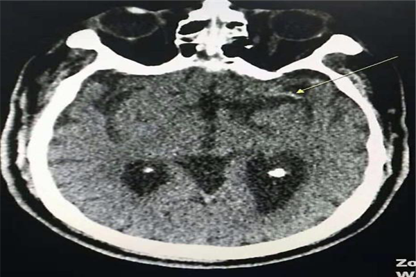 圖片1.png 圖片1.png