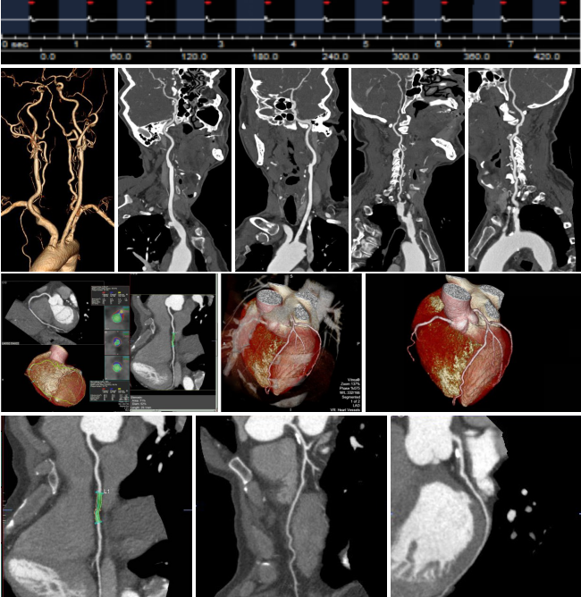 151515151515.png 151515151515.png