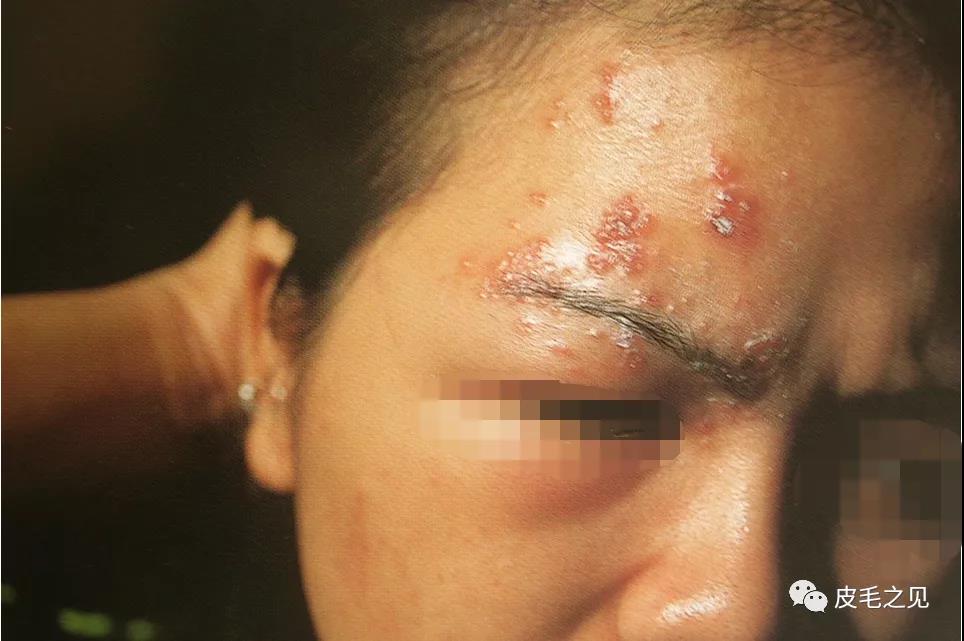 面部.jpg 面部.jpg