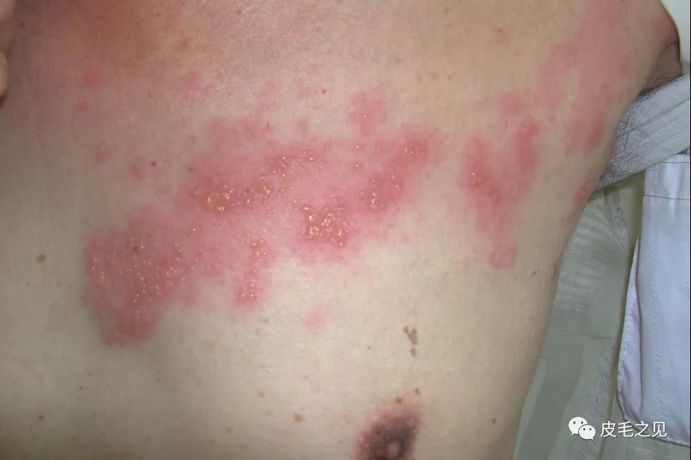 胸部.jpg 胸部.jpg