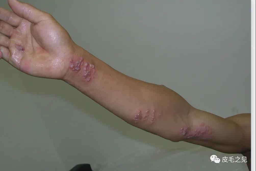 上肢.jpg 上肢.jpg