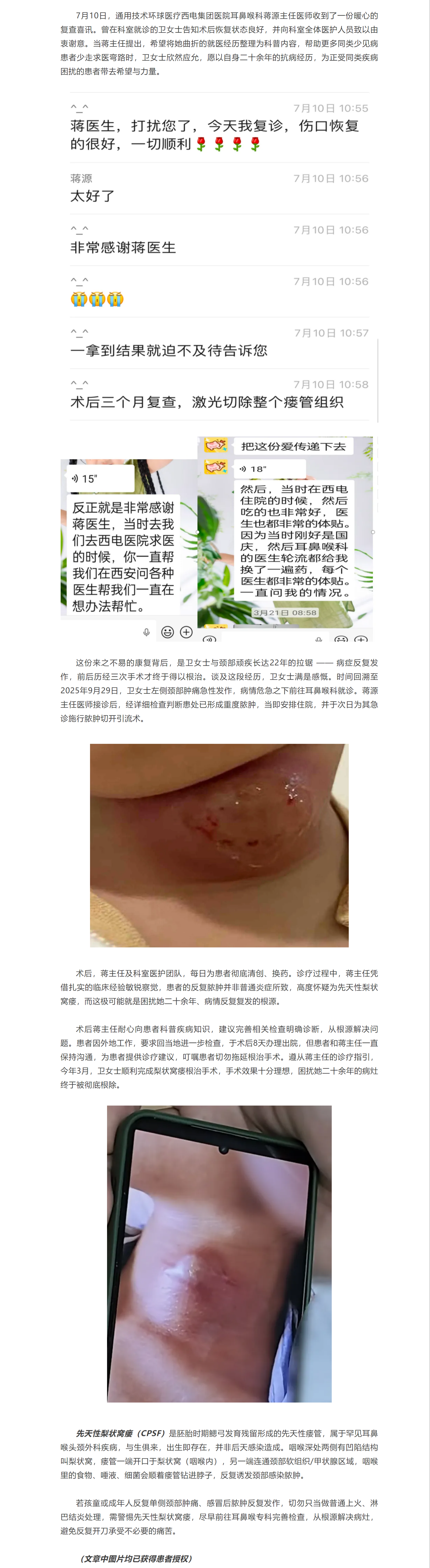 從反復(fù)膿腫到徹底根治！西電集團(tuán)醫(yī)院耳鼻喉科患者自愿分享罕見病就醫(yī)歷程，助力健康科普.png