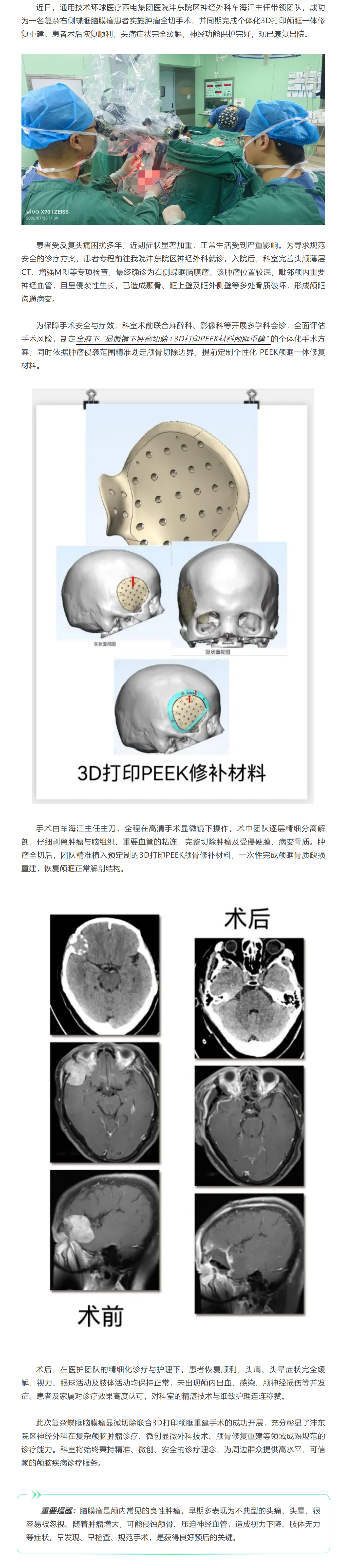 精準(zhǔn)除瘤 修復(fù)顱骨｜西電集團(tuán)醫(yī)院灃東院區(qū)神經(jīng)外科成功救治復(fù)雜蝶眶腦膜瘤.png