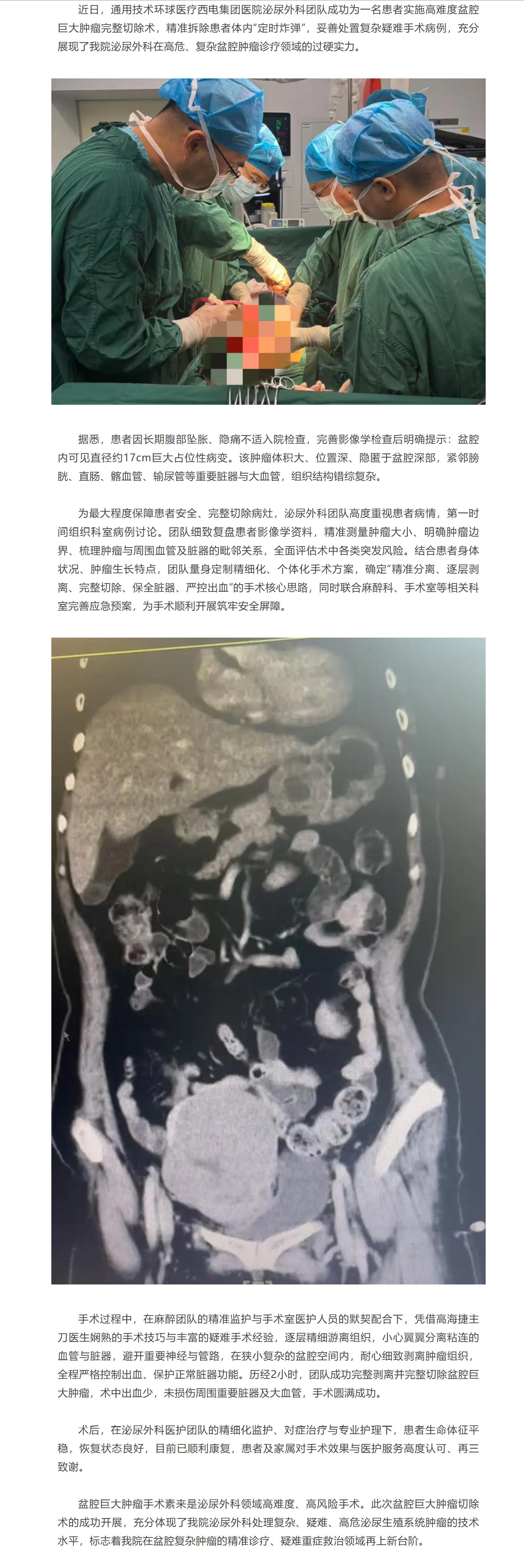 西電集團(tuán)醫(yī)院泌尿外科成功完成高難度盆腔巨大腫瘤切除術(shù).jpg